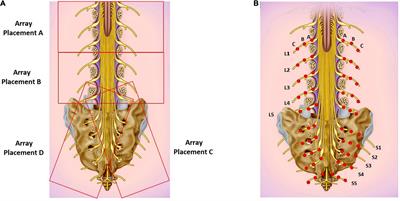 Modulation of the autonomic nervous system by one session of spinal low-level laser therapy in patients with chronic colonic motility dysfunction